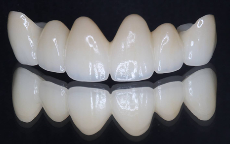 患者様の「口元をもっと美しくしたい」というご要望にお応えするため、審美歯科治療とホワイトニングを提供しています。