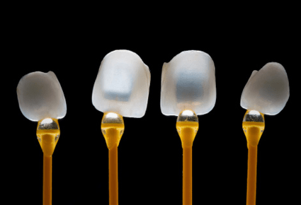 歯の見た目を美しく改善します