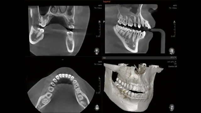 見た目の美しさと自然な噛み心地の両方を大切にしている