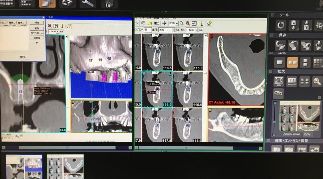 デジタルレントゲンにより正確な診断が行われています