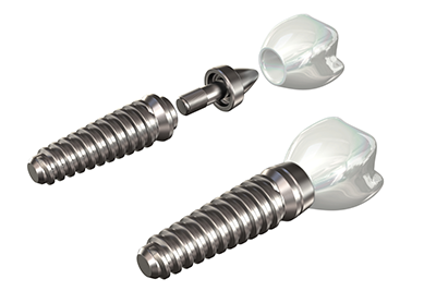 歯科用CTを活用して事前の精密な診断を行っています