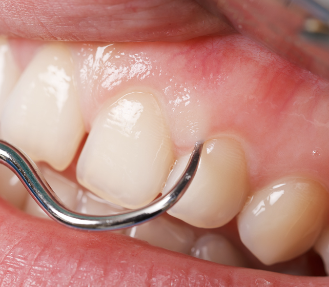 歯周病の予防と治療を通じて、患者様の健康を支える診療を行っています