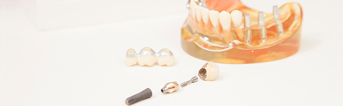 顎骨の吸収が少ないチタン製のインプラントを使用し、安全で長期的に安定した治療を提供します。