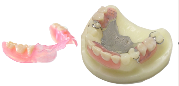 それぞれの患者様に合った義歯をご提案し、装着後のフォローまで丁寧に対応しています。