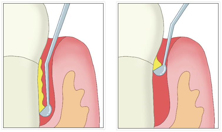 見えない部分はプロがケアします