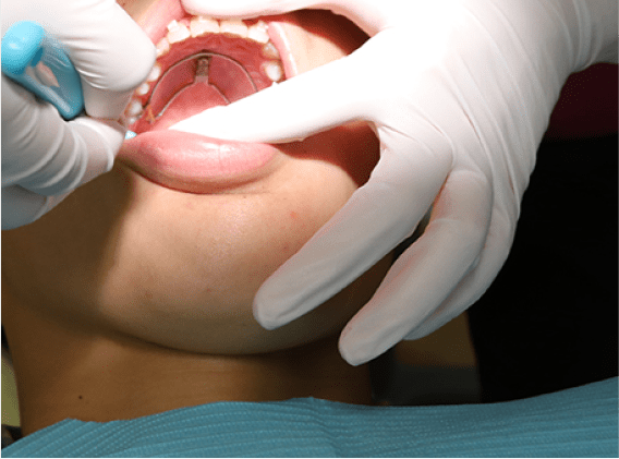 保険適用の矯正治療にも対応