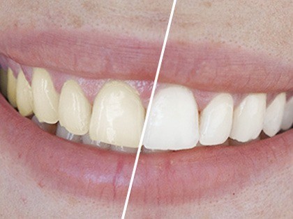 審美性を保つためのクリーニングやトリートメントも行い、美しい口元づくりを総合的に支えています。