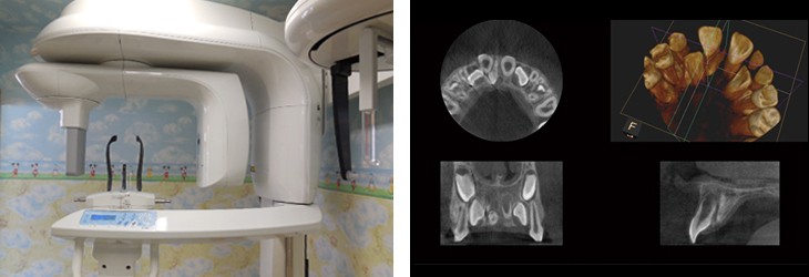 歯科用CT