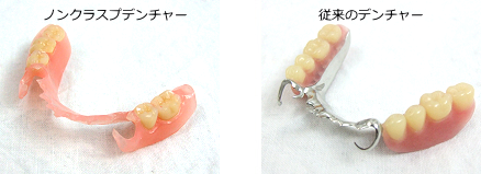 薄くて軽い入れ歯で快適に