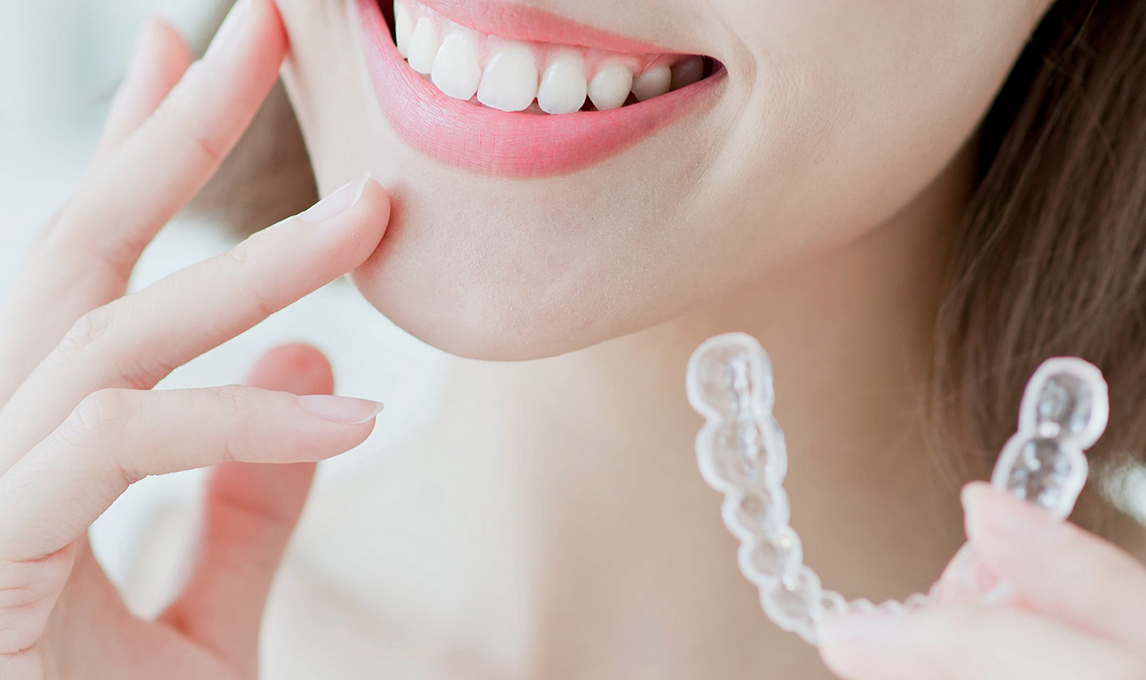 3D口腔内スキャナーによる歯型とり、マウスピース型矯正装置を作製