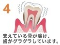 健康な歯茎を維持するためのサポートを徹底しています