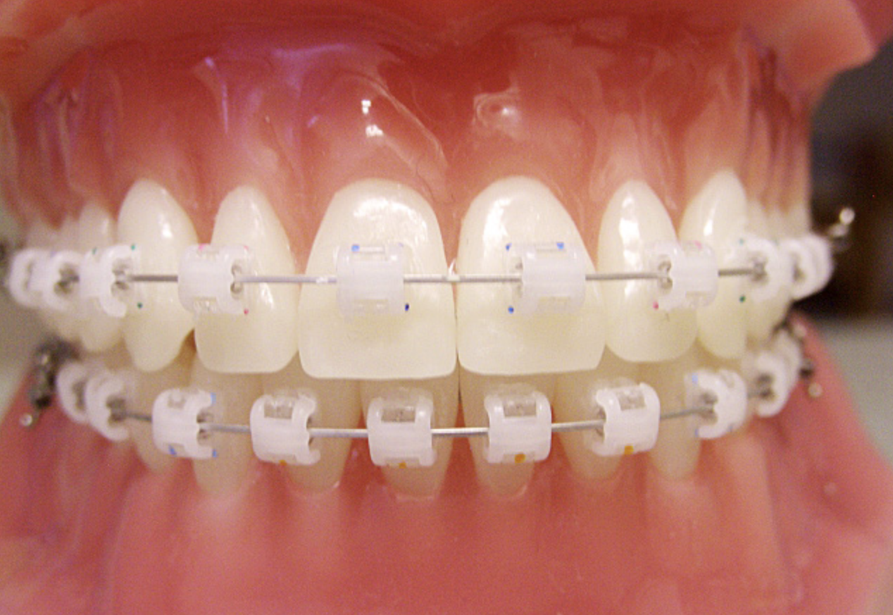 きれいな歯並びと良い咬み合わせの為の矯正治療！専門の矯正医&担当医師が連携だから安心