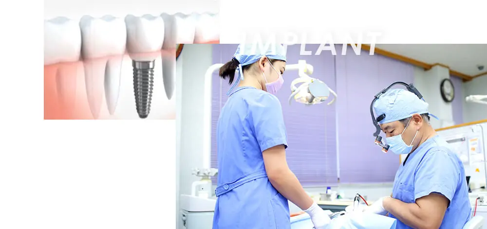 1本から複数歯の欠損まで、状態に応じた提案がされています