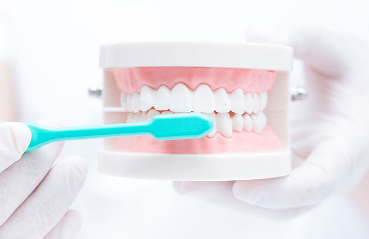 歯の健康を守るための予防プログラム