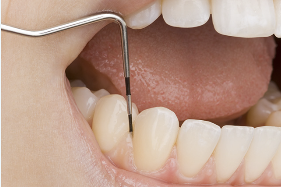 症状がなくても定期検診を受けることで、早期発見・早期治療につなげることができます