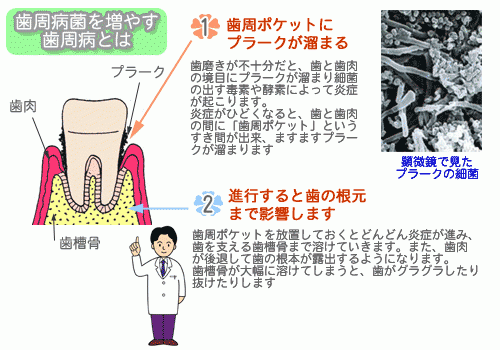 歯ぐきの状態が全身の健康にもつながるという視点から、歯周病治療の継続的な管理が行われています