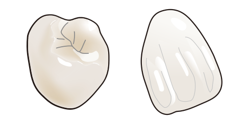 金属を使わず自然な見た目を重視しています。