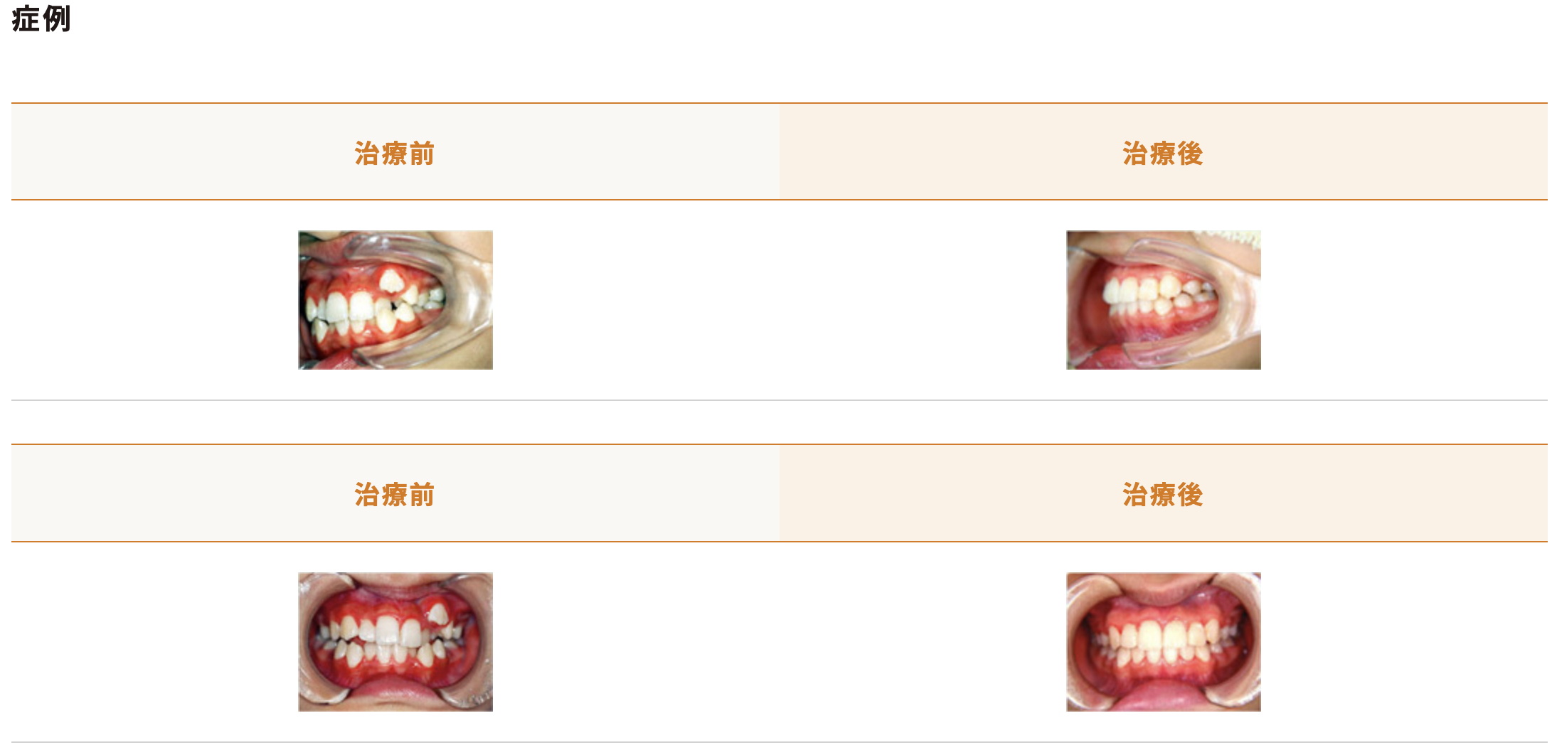 美しい歯並びと正しい咬み合わせを目指し、矯正歯科の治療を行っています
