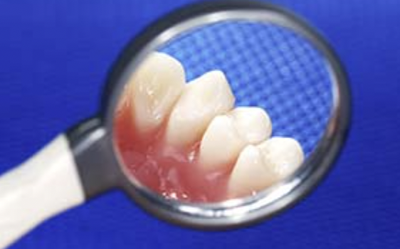 症状悪化を防ぐための適切な治療を行います