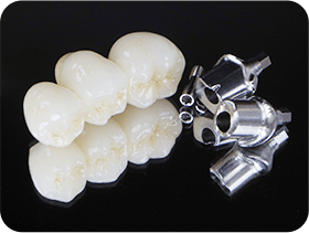 オールセラミッククラウン