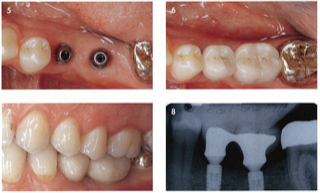 診断・計画しっかり提案いたします