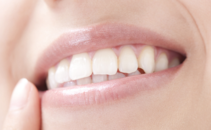 Tスキャンを使用します