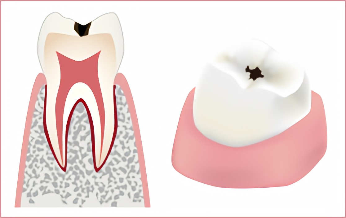 早期発見、早期治療が大切です