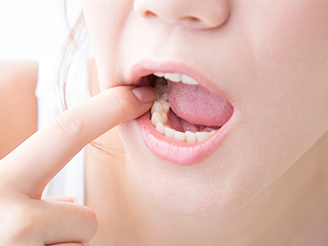 気になる歯並びをきれいにしませんか