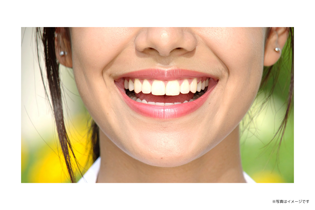 金属を使用せず自然な白さと透明感を引き出しています