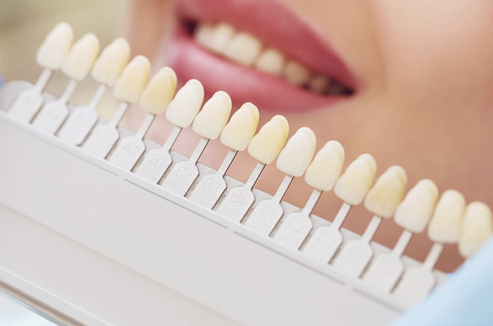 高校生以上の方がホワイトニングが可能です