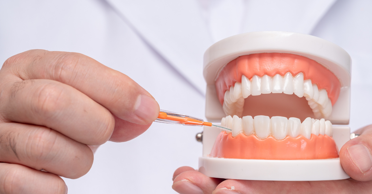 セラカルLCを用いた歯髄保存で将来の歯の喪失リスクを低減