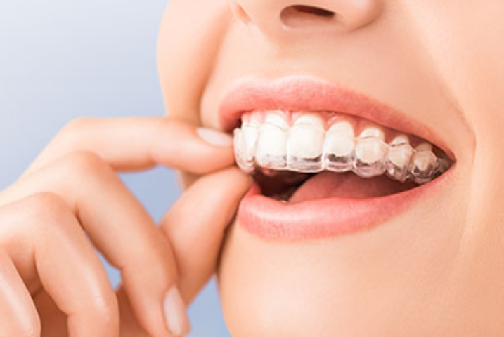 お子様から大人まで安心の矯正歯科治療