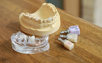 「患者様の歯をできるだけ守り、健康を長く維持すること」