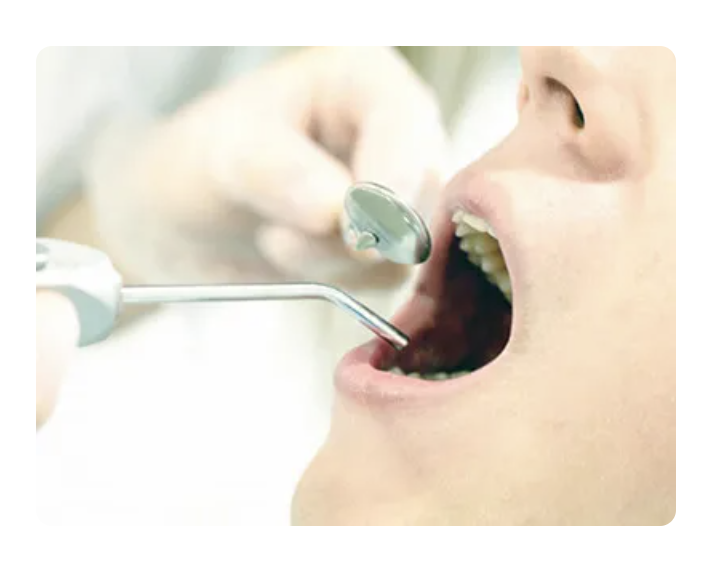 患者様のご希望や噛み合わせの状態に応じて適したものを提案します