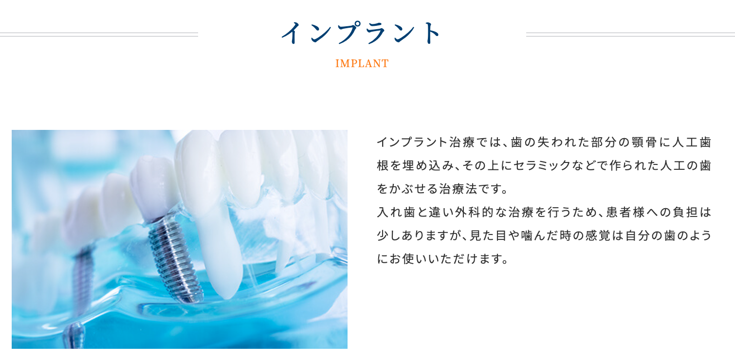 精密な診断と計画に基づき、患者様の状態に合わせたインプラントを提供しています