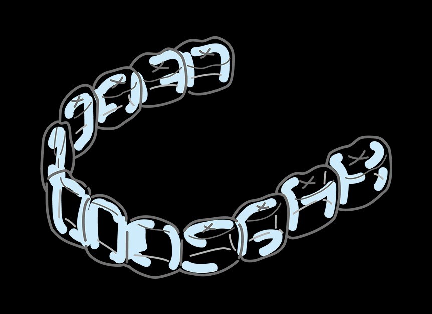 見た目への負担を抑えながら、歯並びの改善を目指したい方に適した矯正方法です。
