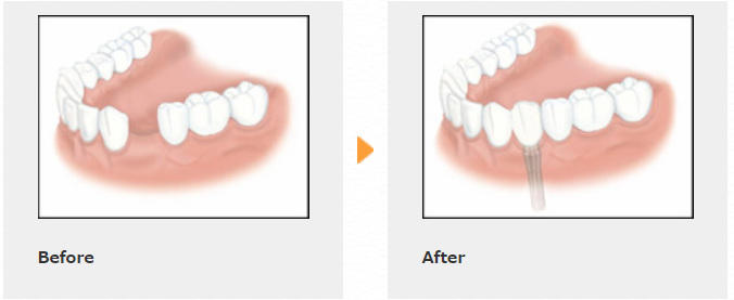 1本からでも自然な見た目を維持できます