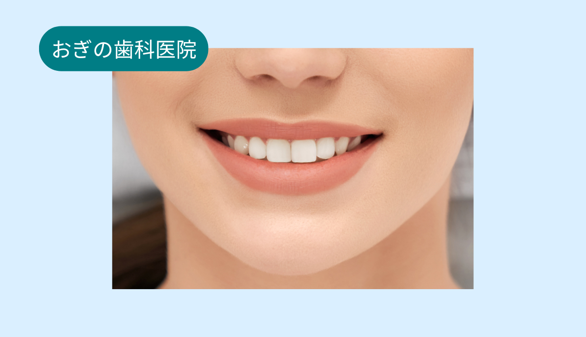 見た目を気にせず始められる、マウスピース型矯正