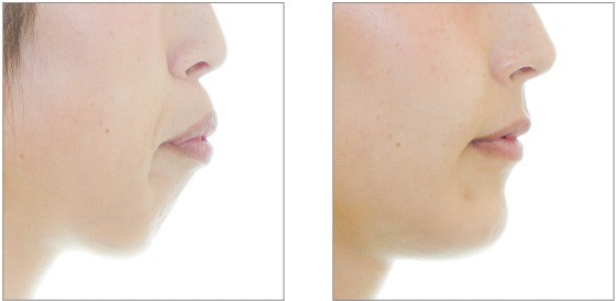 治療前と治療後の比較