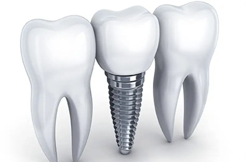 精密な診断と世界水準の技術で天然歯のような噛み心地を追求しています