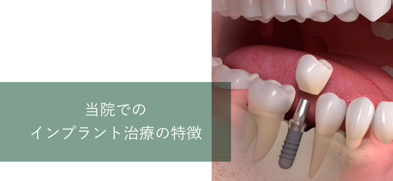 他院で、インプラントをお断りされた方でも、先端の塗料技術によって対応が可能です。