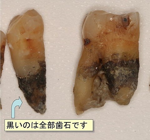 早めに対処が大切です