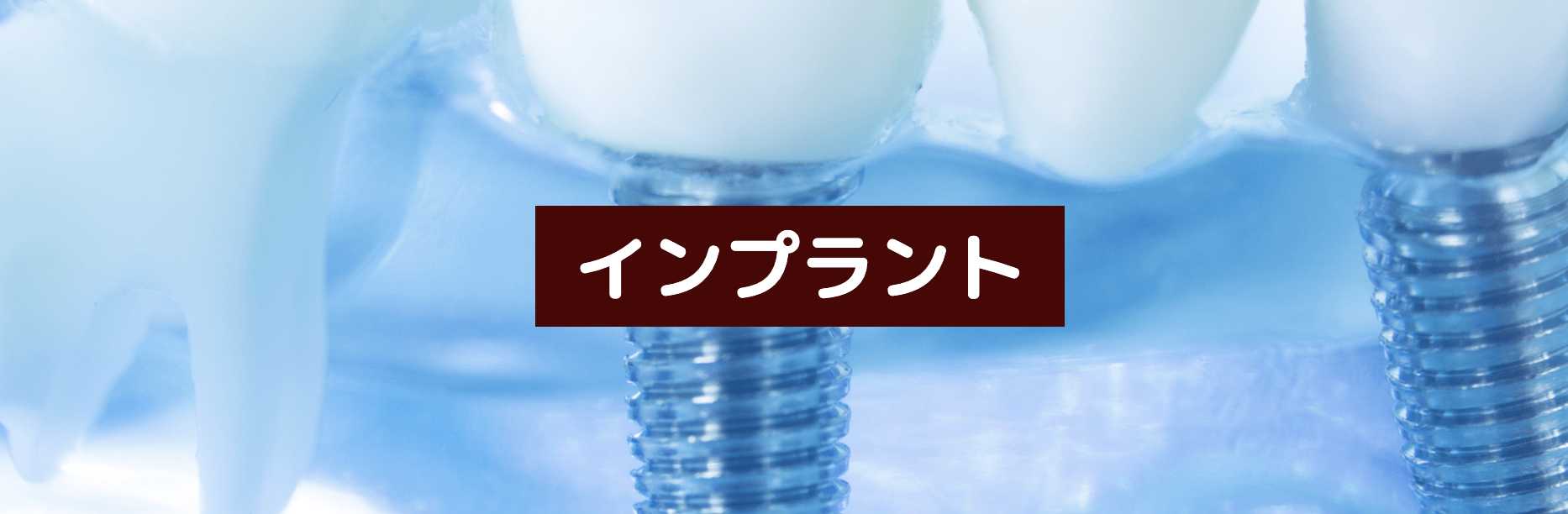 耐久性や適合性に優れた高品質なインプラントシステムを採用しています