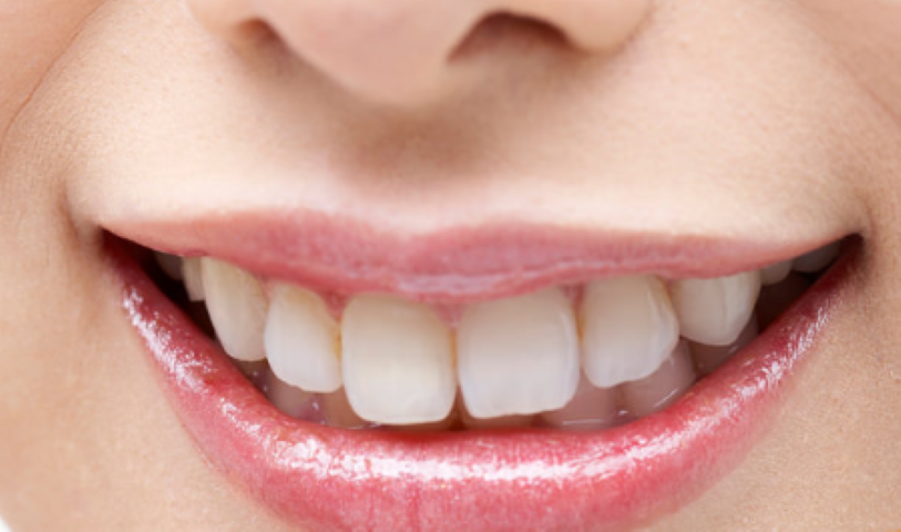 機能と美しさを兼ね備えた歯のケア