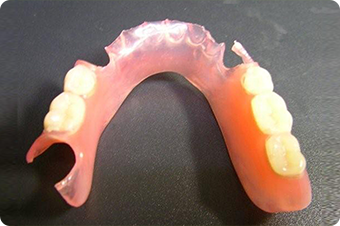 バルプラスという自費による入れ歯です