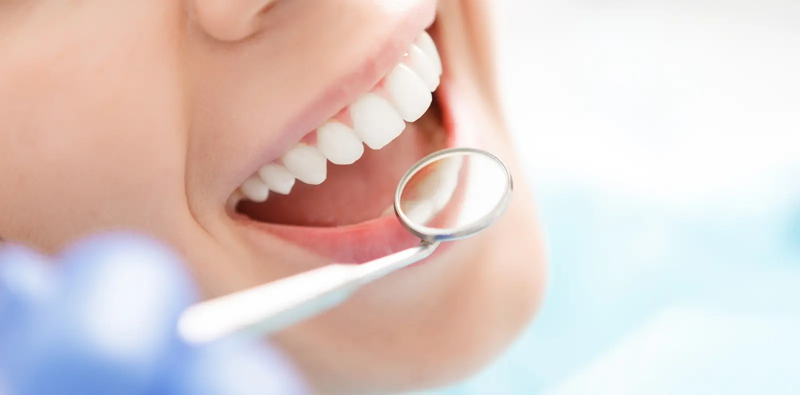 【河原町バス停 徒歩1分】精密診断と低侵襲治療を行う井上歯科クリニック