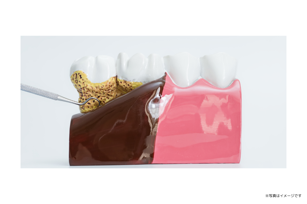 歯を支える土台を整え全身の健康維持をサポートしています