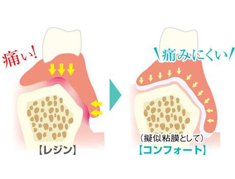 有床義歯-痛くない、外れにくい！シリコン入れ歯で食生活が変わる