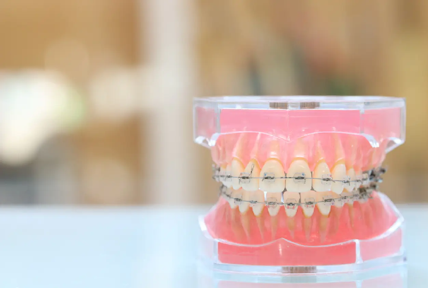 目立たず自然な矯正治療