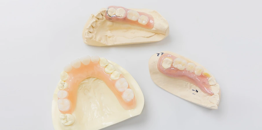 見た目も噛み心地も妥協しない、次世代の入れ歯「ミラクルデンチャー」